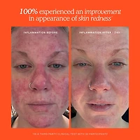 Vaporisateur visage quotidien SOS avec acide hypochloreux