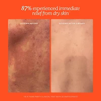 Vaporisateur visage quotidien SOS avec acide hypochloreux
