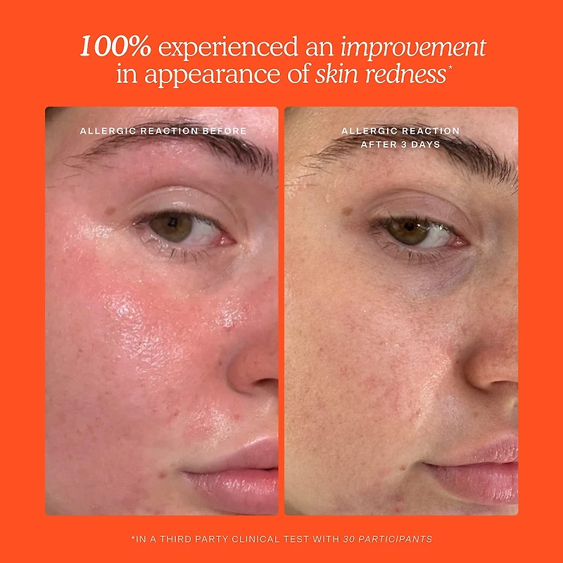 Vaporisateur visage quotidien SOS avec acide hypochloreux