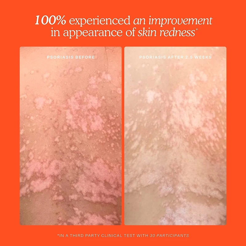 Vaporisateur visage quotidien SOS avec acide hypochloreux
