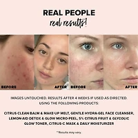 NUDESKIN Lemon-Aid Detox & Glow Micro-Peel