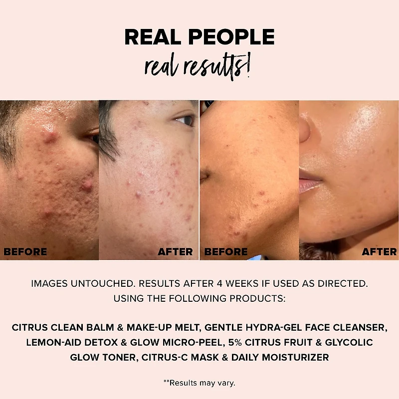 NUDESKIN Lemon-Aid Detox & Glow Micro-Peel