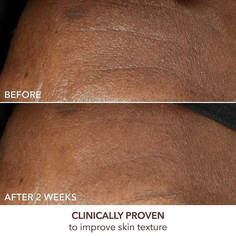Crème antirides intense Advanced Retinol + Ferulic