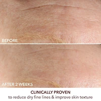 Crème antirides intense Advanced Retinol + Ferulic