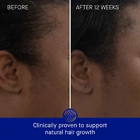 The Scalp Treatment
