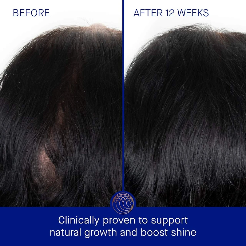 The Scalp Treatment
