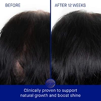 The Scalp Treatment