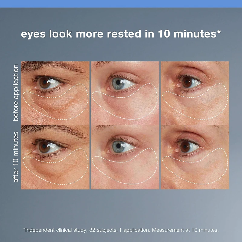 Gel anti-poches sous les yeux