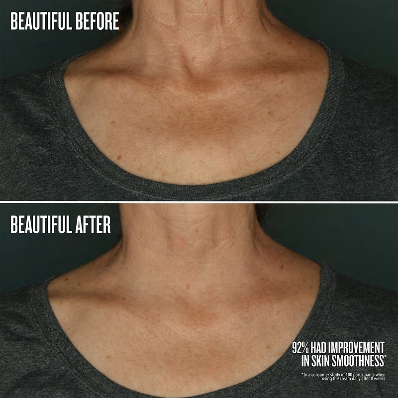 Beija Flor™ Body Collagen-Boosting Elasti-Cream with Polypeptides and Bio-Retinol