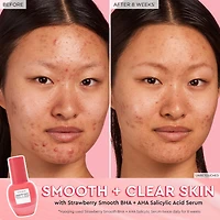 Sérum à l’acide salicylique avec BHA + AHA Strawberry Smooth