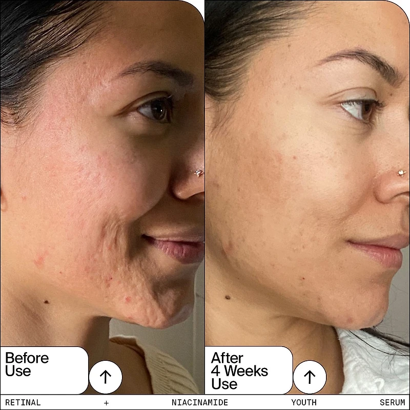 Retinal + Niacinamide Youth Serum