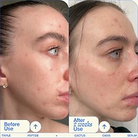Sérum Oasis hydratant et raffermissant triple peptide avec acide hyaluronique