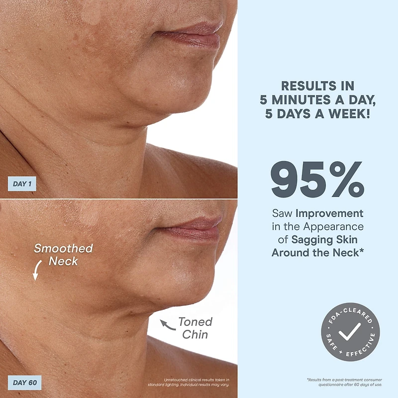 NuFACE® Mini+ Petite Facial Toning Device