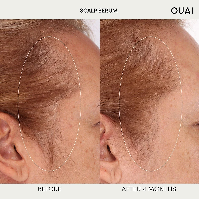 Hydrating Scalp Serum for Healthy, Fuller Looking Hair