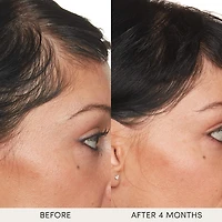 Hydrating Scalp Serum for Healthy, Fuller Looking Hair