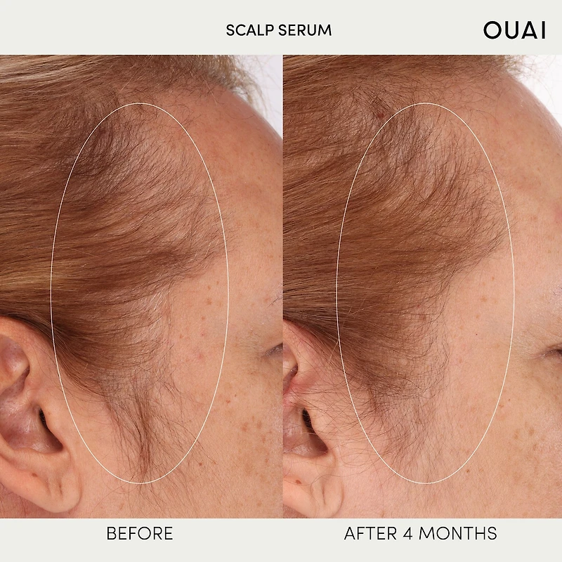 Sérum hydratant pour cuir chevelu, pour des cheveux sains et plus volumineux