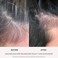 GRO AGELESS Anti-Gray Hair Serum