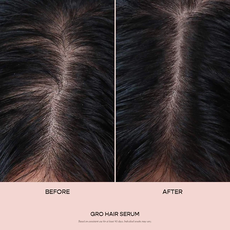 Sérum pour les cheveux GRO clairsemés