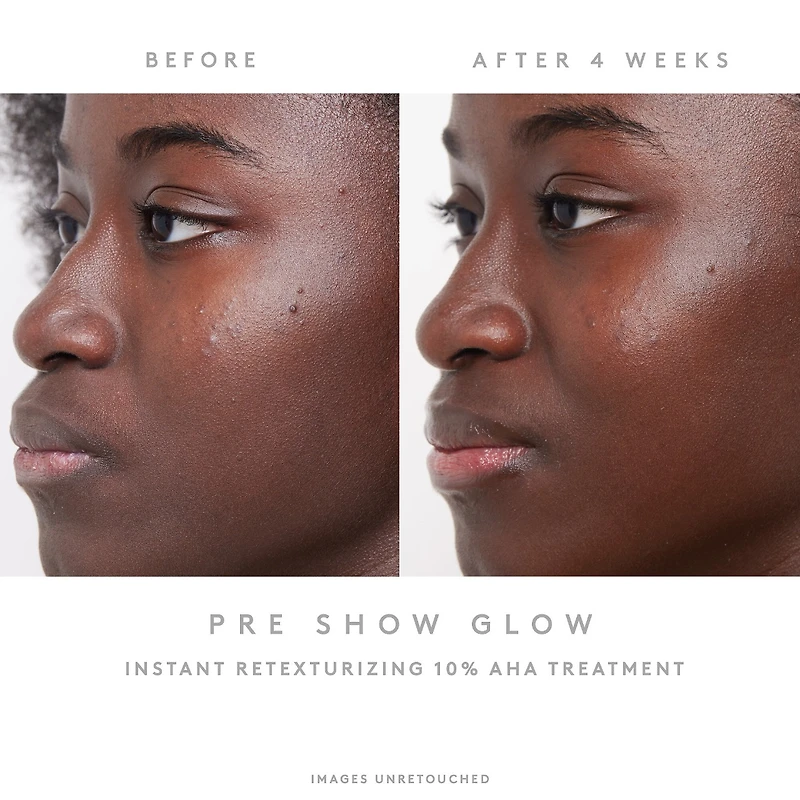 Pre-Show Glow Refillable Instant Retexturizing 10% AHA Treatment