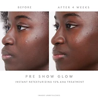Pre-Show Glow Refillable Instant Retexturizing 10% AHA Treatment