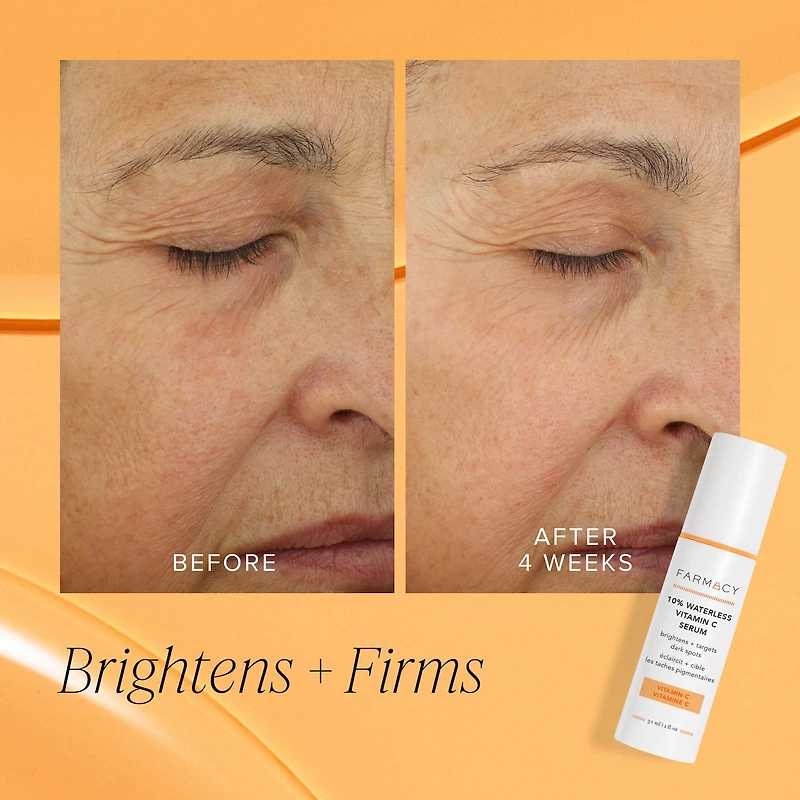 10% Waterless Vitamin C Serum