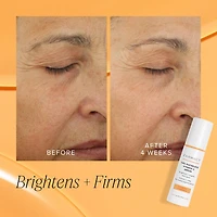 10% Waterless Vitamin C Serum