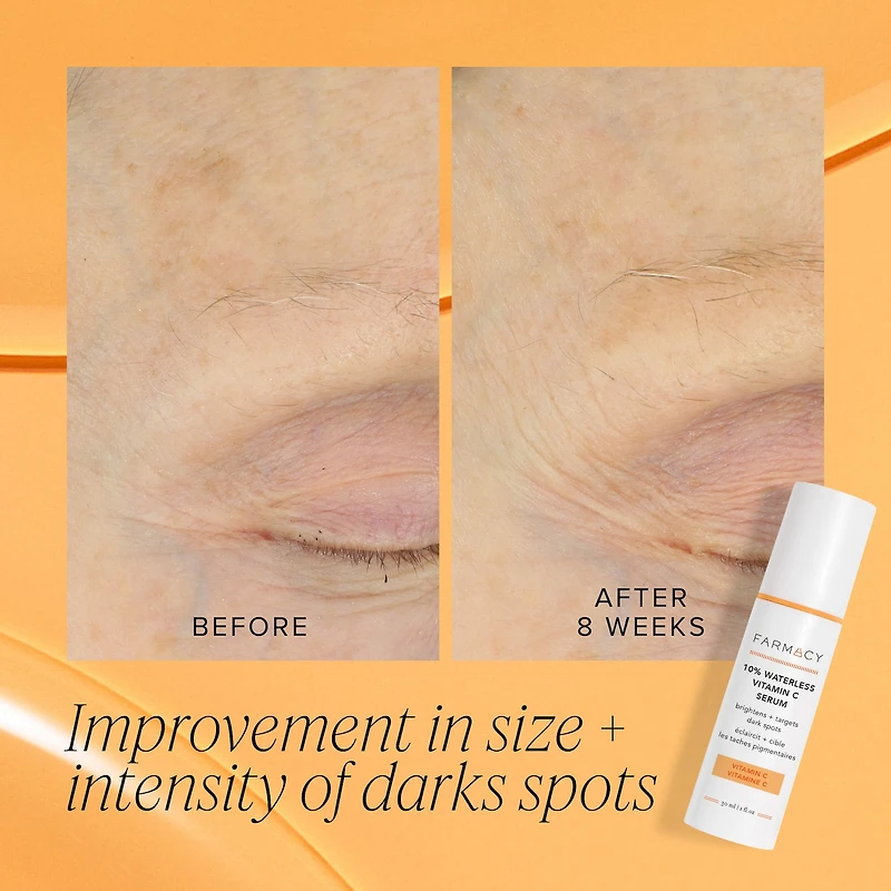 10% Waterless Vitamin C Serum
