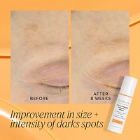 10% Waterless Vitamin C Serum