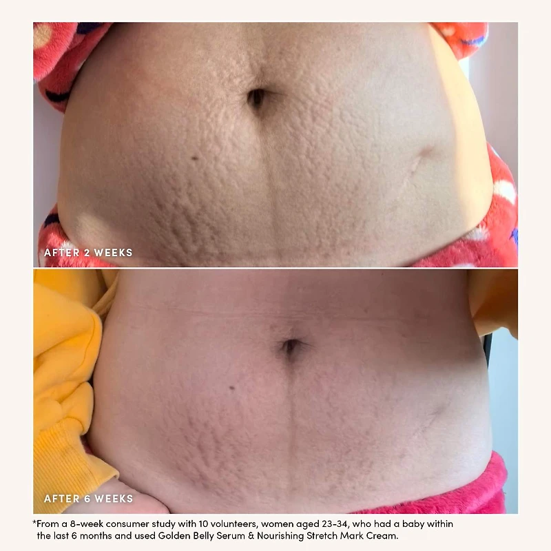 Nourishing Stretch Mark Cream