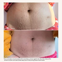 Nourishing Stretch Mark Cream