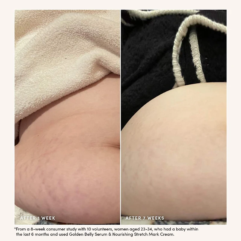 Nourishing Stretch Mark Cream