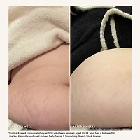 Nourishing Stretch Mark Cream
