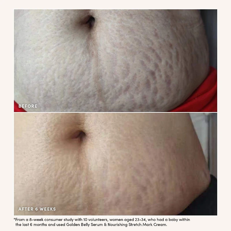 Nourishing Stretch Mark Cream
