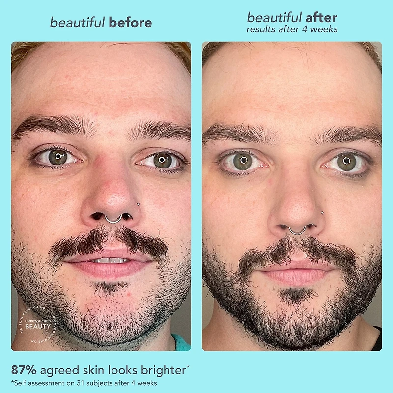 Bright Start Vitamin C Antioxidant Brightening Moisturizer