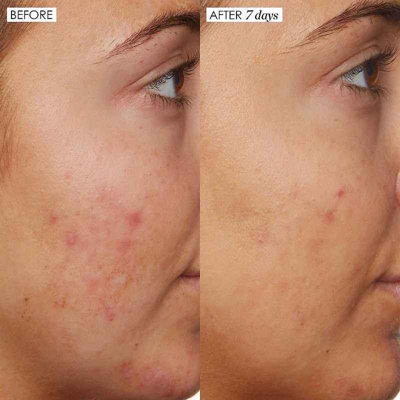 B3 Nice 10% Niacinamide serum