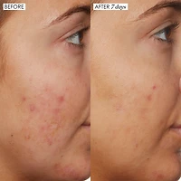 B3 Nice 10% Niacinamide serum