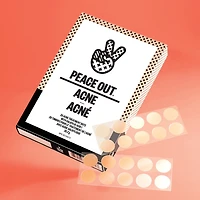 Salicylic Acid Acne Healing Dots