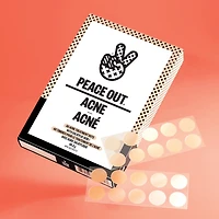 Salicylic Acid Acne Healing Dots