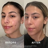 Firming & Plumping Vegan Collagen Prep Serum