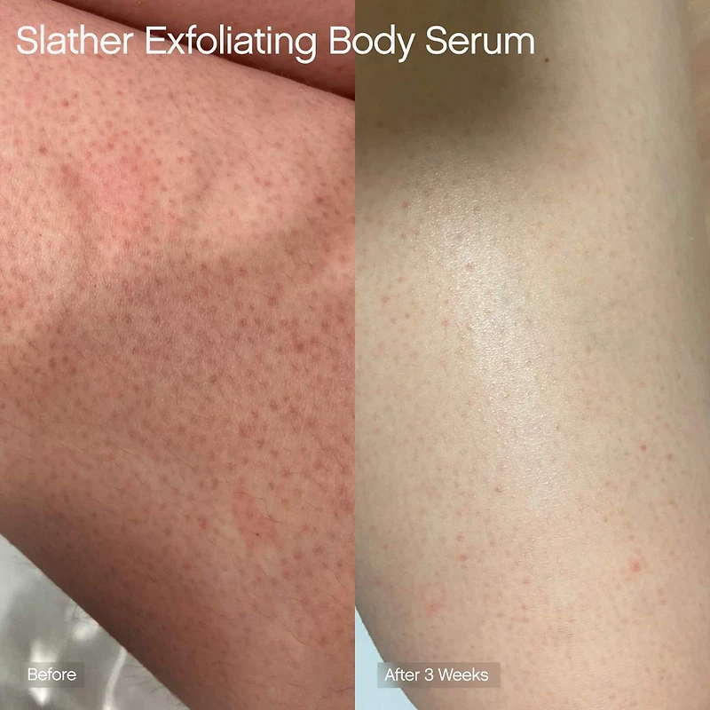 Sérum exfoliant pour le corps avec rétinol et AHA Slather