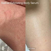 Sérum exfoliant pour le corps avec rétinol et AHA Slather