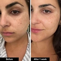 Retinol Remix 1% Retinol Treatment With Peptide & Tranexamic Acid