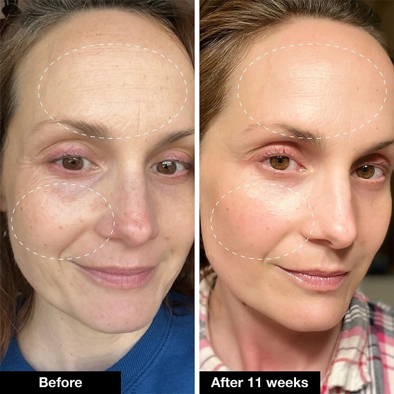 Retinol Remix 1% Retinol Treatment With Peptide & Tranexamic Acid
