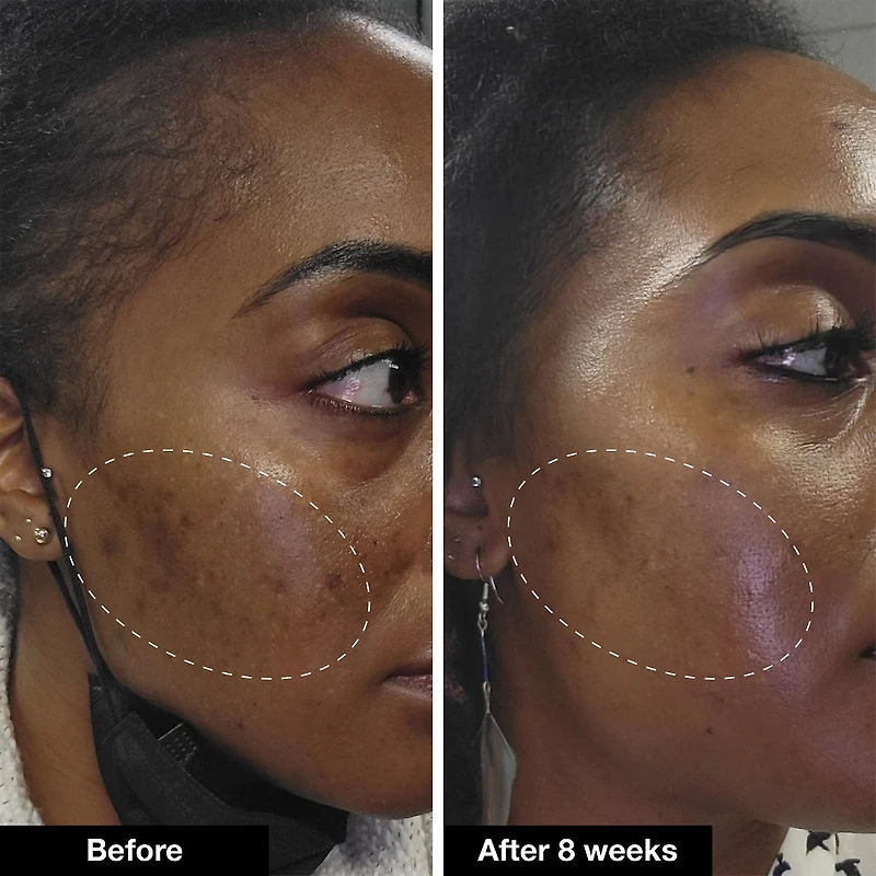 Retinol Remix 1% Retinol Treatment With Peptide & Tranexamic Acid