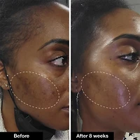 Retinol Remix 1% Retinol Treatment With Peptide & Tranexamic Acid