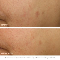 GOOPGLOW Exfoliating Dark Spot Sleep Serum