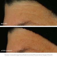 GOOPGLOW Exfoliating Dark Spot Sleep Serum