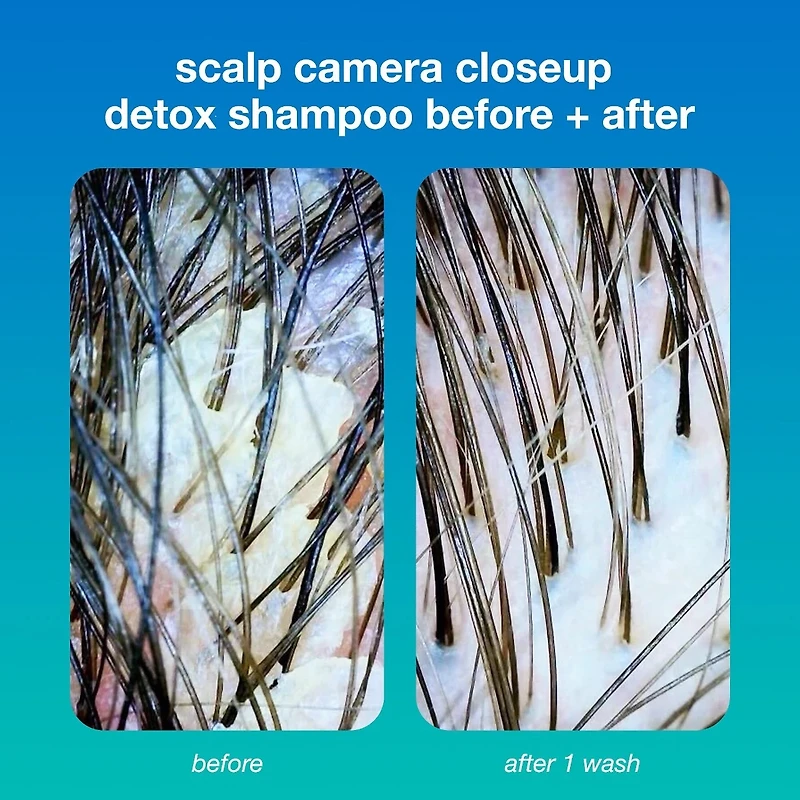 PEPTIDE PREP™ Clarifying Detox Shampoo