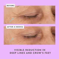 Crème pour les yeux Ceramighty™ AF avec céramides