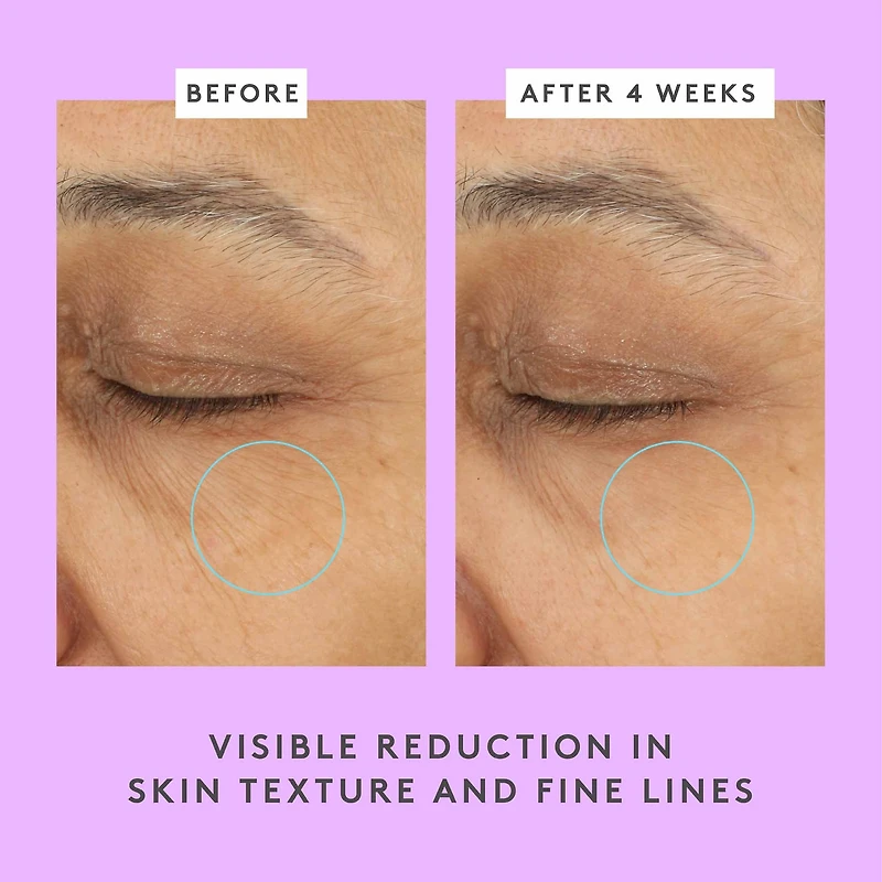 Crème pour les yeux Ceramighty™ AF avec céramides
